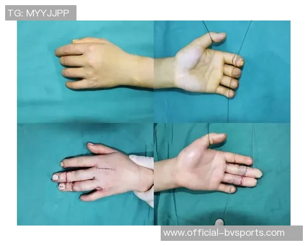 黄威手术时间确定将于10月10日进行恢复计划全力以赴期待重返赛场 黄威手术时间确定将于10月10日进行恢复计划全力以赴期待重返赛场